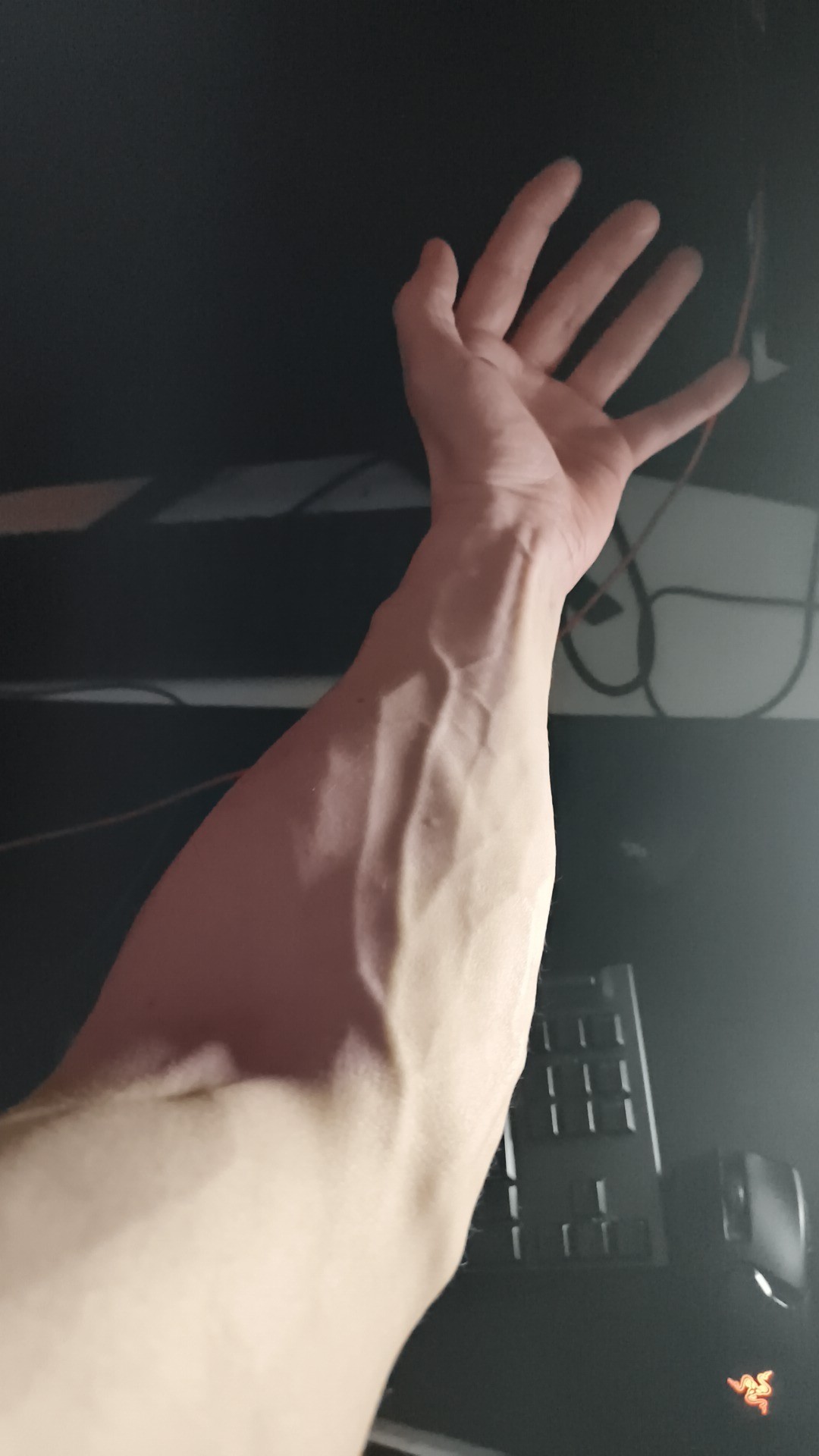 Bild av vaskulär arm